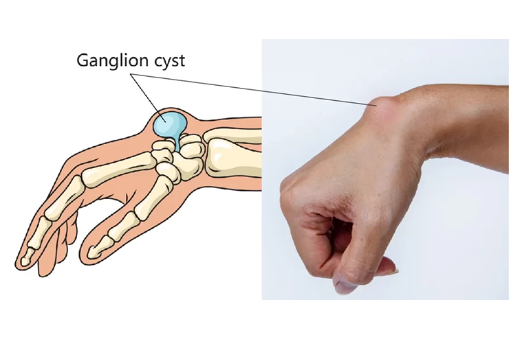 Companion Care